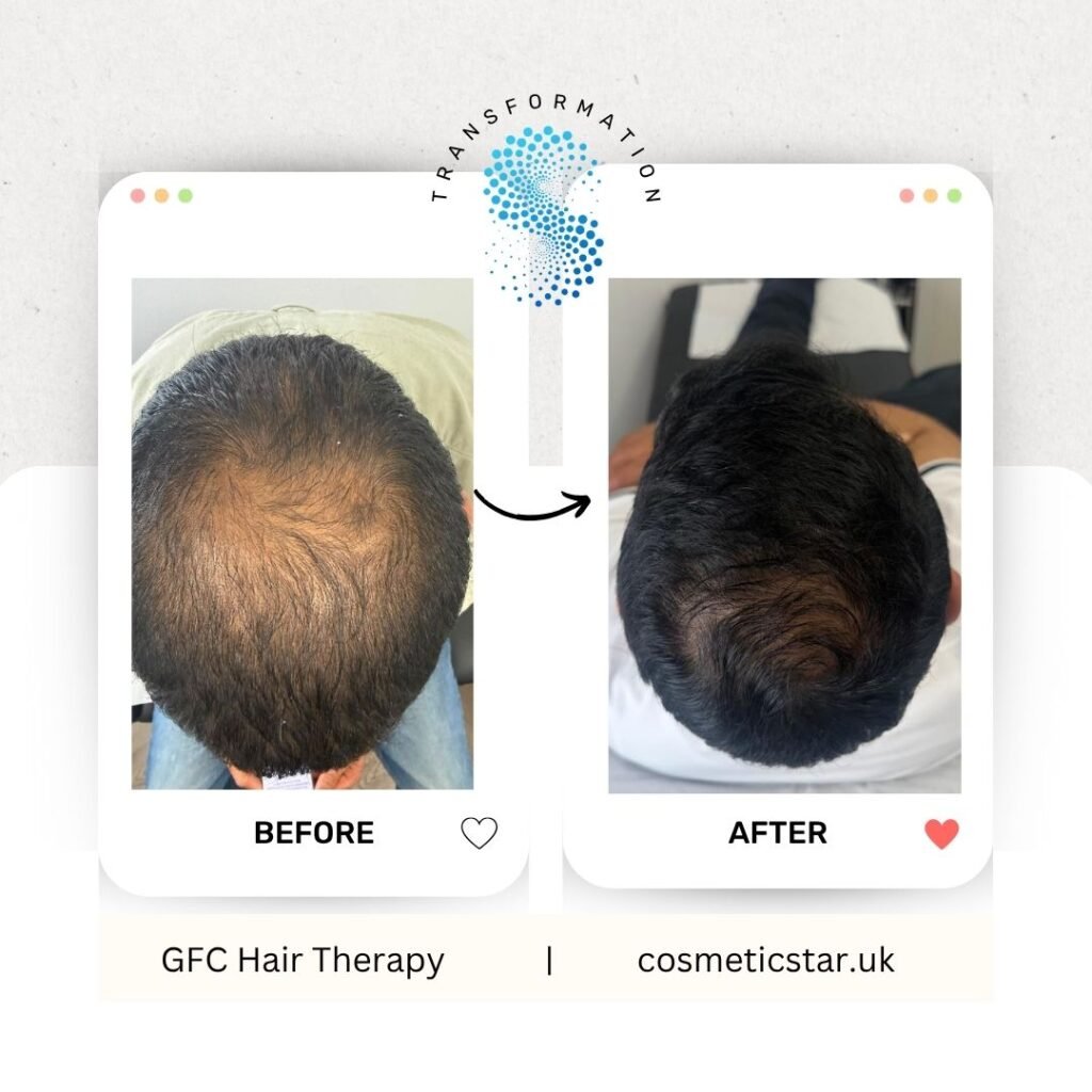 GFC Hair