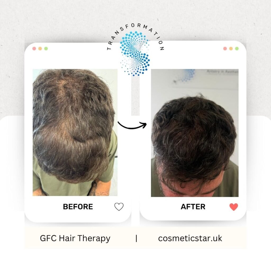 GFC hair before after