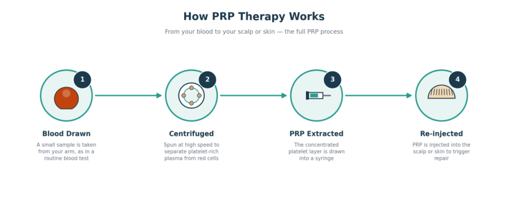 How PRP Therapy Works
